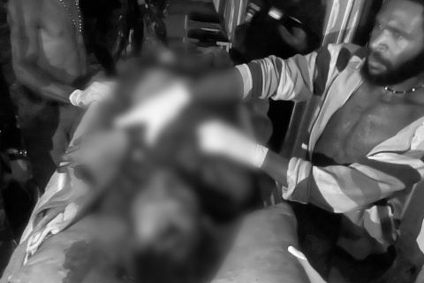 KKB Aibon kogoya pelaku penyerangan Puskesmas Beoga Barat