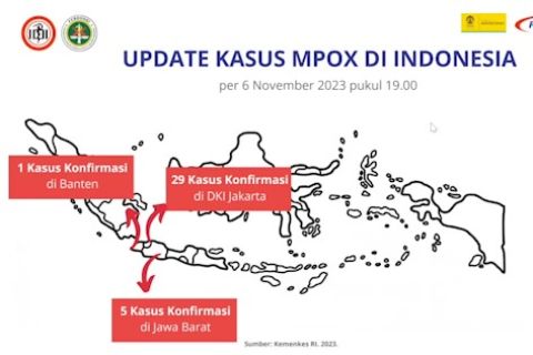 Kasus cacar monyet di Indonesia bertambah jadi 35 kasus