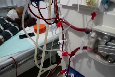 BPJS jamin biaya skrining hingga pengobatan penyakit ginjal