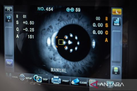 Hoya Lens Indonesia gelar pemeriksaan mata gratis guna bantu penurunan prevalensi gangguan penglihatan di Indonesia.