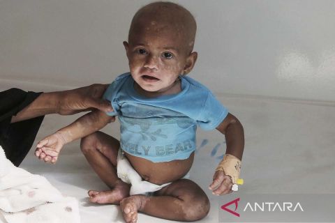 Perang saudara berkepanjangan, ribuan warga Yaman diambang kelaparan