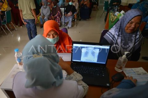 Pelayanan rontgen gratis di Padang