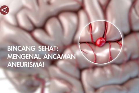 Bincang Sehat: Mengenal ancaman aneurisma!