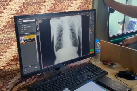 Menkes ungkap alasan Indonesia jadi lokasi uji klinis vaksin TBC