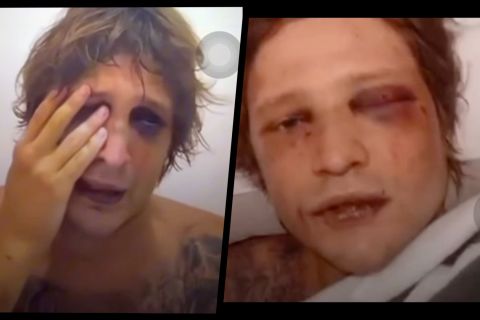 Polda Bali ajukan red notice Interpol tersangka penculikan WN Ukraina