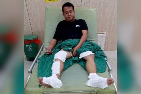 Polda Babel dalami kasus penyiraman air keras aktivis lingkungan