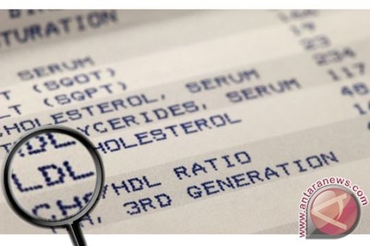 Lawan Lonjakan Kolesterol Jahat dengan Teh Pahit