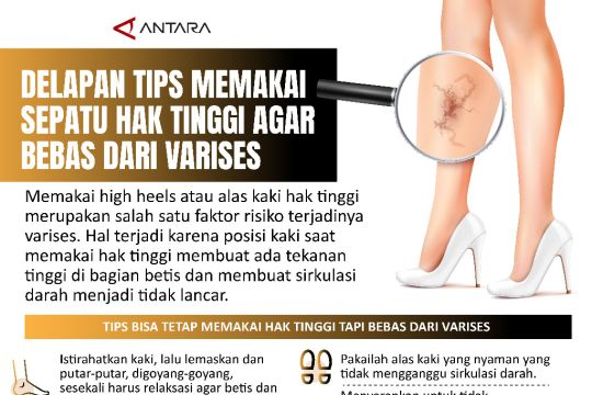 Delapan tips memakai sepatu hak tinggi agar bebas dari varises