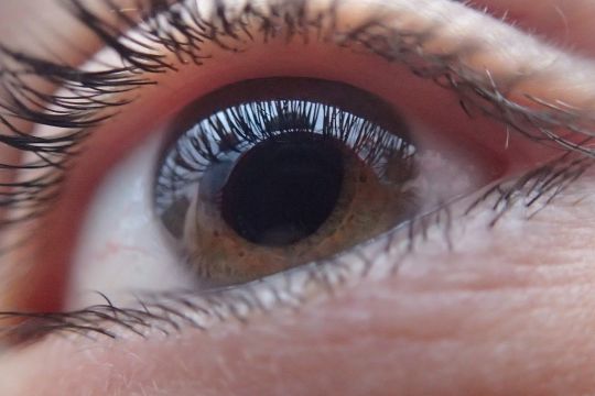Curiga kena glaukoma? Coba tutup mata bergantian