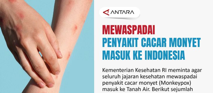 Mewaspadai penyakit cacar monyet masuk ke Indonesia
