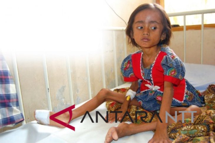 E Nusa Tenggara fights to combat childhood stunting