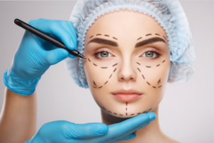 Anda berminat operasi hidung? Ini syaratnya