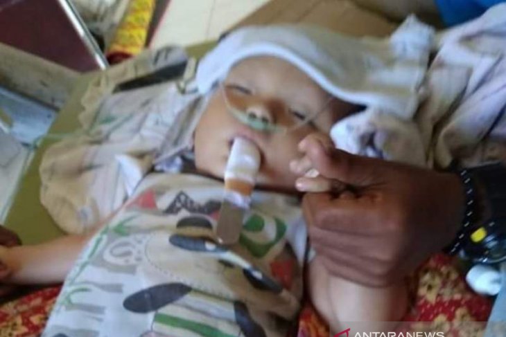 Bayi penderita infeksi otak di Bangka Brat butuh bantuan berobat