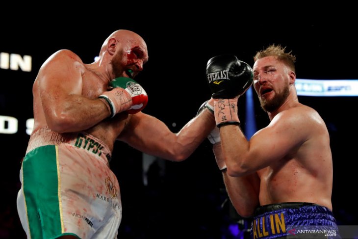 Dapatkan 40 jahitan, Tyson Fury nyatakan siap