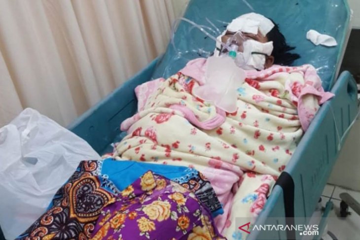 Kasus suami bakar istri, kondisi korban semakin membaik