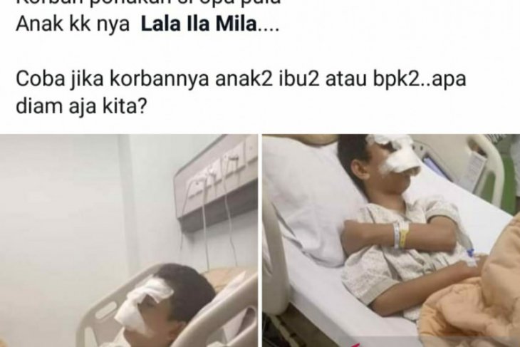 Pelajar SMP di Pekanbaru jadi korban perundungan hingga terkapar di rumah sakit