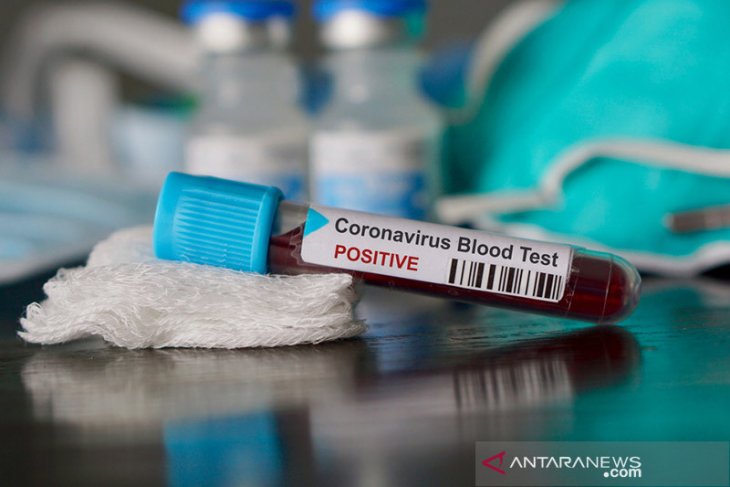 Di sini, uji sampel pasien virus corona selesai sehari