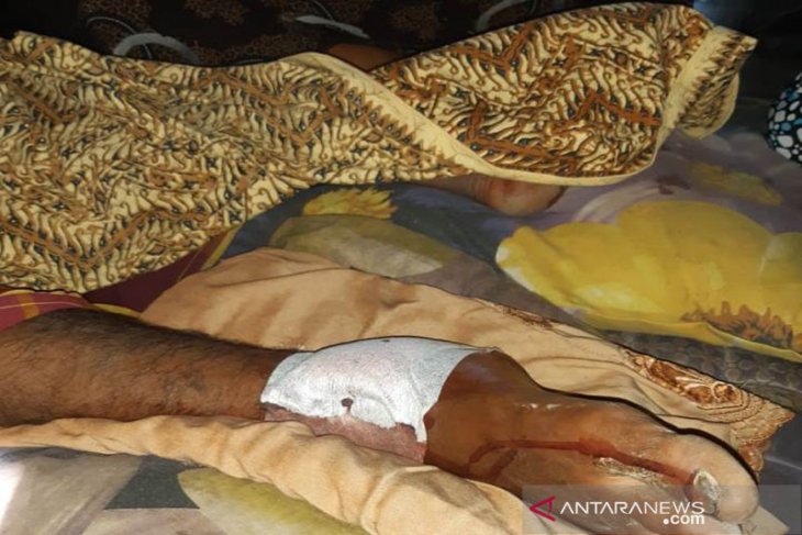 Ngambil air untuk siram tanaman cabai, petani ini diterkam buaya