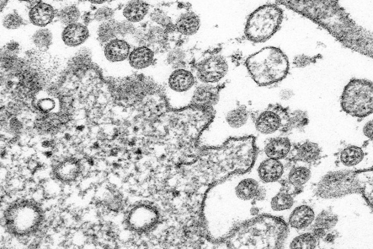 Total kasus virus corona AS mencapai 2.063.812 kasus