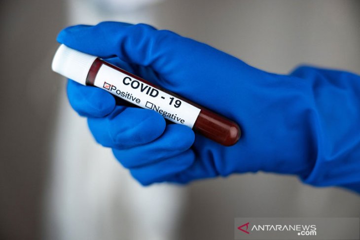COVID-19, AS cabut larangan impor sarung tangan medis dari Malaysia