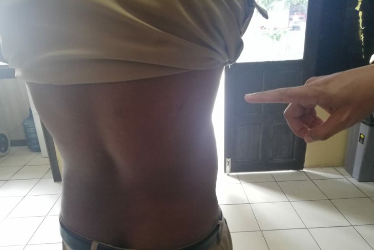 Sekdes Engkasan melaporkan pengeroyokan dirinya terkait bantuan COVID-19
