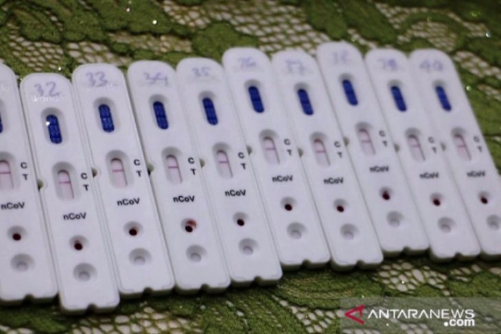 Hasil rapid test 954 warga Kalbar dinyatakan reaktif
