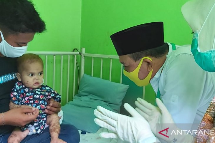 Bupati santuni pasien balita alami kelainan kulit