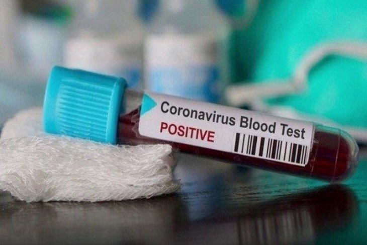 Total positif COVID-19 di Indonesia jadi 121.226 orang dengan 77.557 sembuh