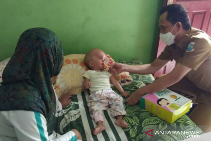 Pemkot Pangkalpinang siap fasilitasi pengobatan balita penderita hidrasefalus
