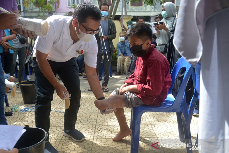 BANTUAN KAKI PALSU UNTUK PENYANDANG DISABILITAS ACEH