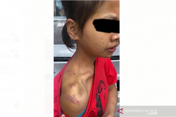Polisi Malaysia tangkap dua orang penyiksa PRT WNI
