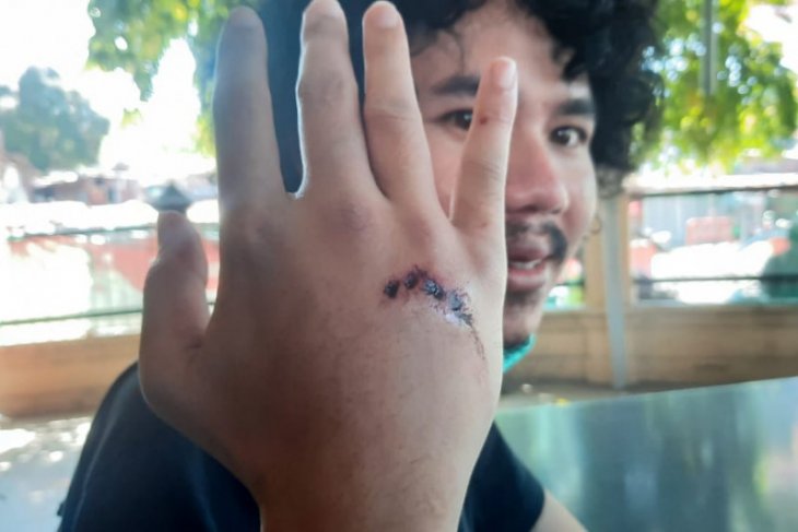 Cari makan sahur, editor Detikcom Surabaya jadi korban begal