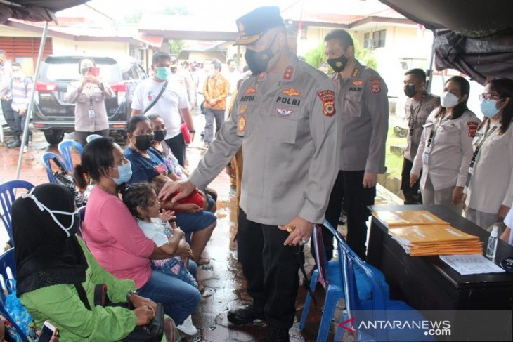 Kapolda Puluhan anak dapat layanan operasi bibir sumbing gratis diapresiasi