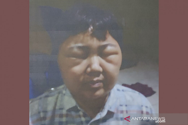 Konsumen lapor ke Polda Bengkulu, pihak salon sebut telah berupaya damai