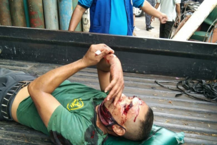 Seorang pekerja luka berat saat tabung oksigen meledak