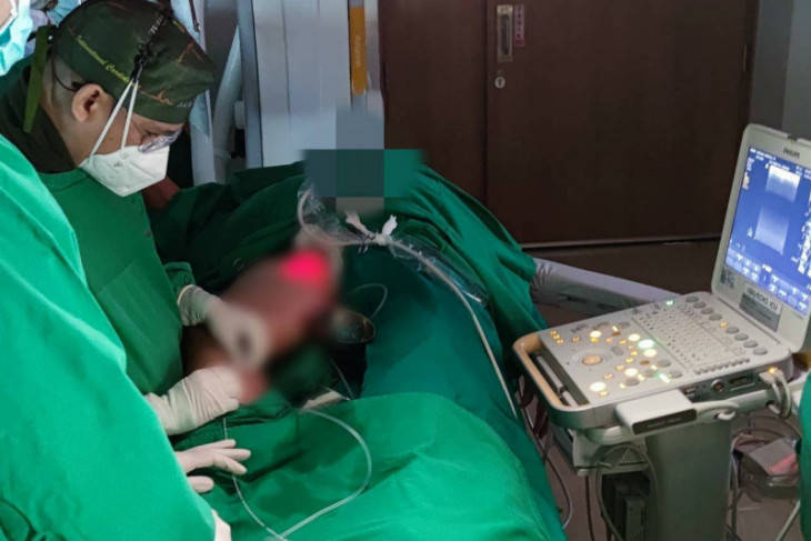 EVLT Teknik Laser Atasi Varises Kaki