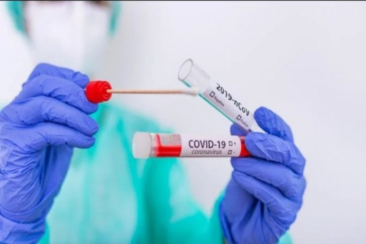 Bertambah terus yang sembuh dari positif COVID-19 di Tebing Tinggi