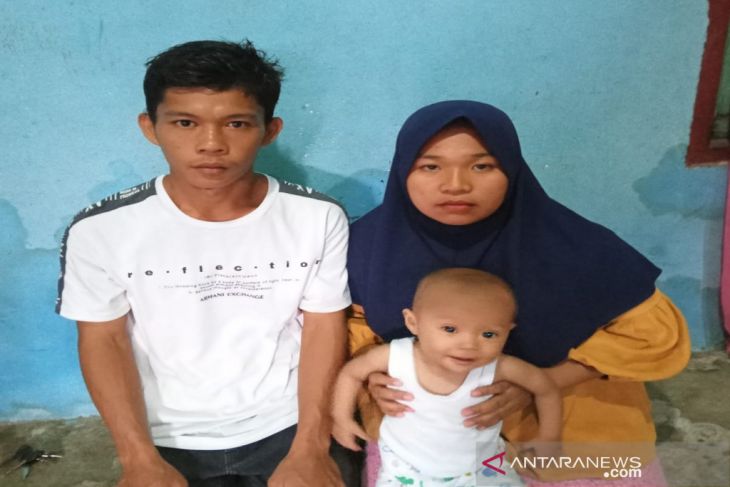 Bayi penderita Jantung bocor di Madina butuh uluran tangan dermawan