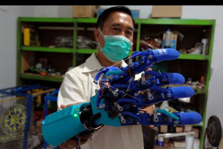 Robot tangan untuk penyandang disabilitas