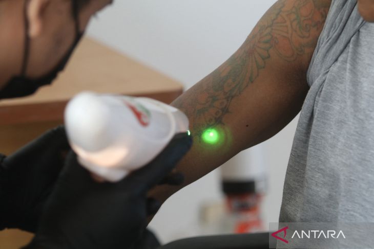 Hapus Tato Gratis di Kediri