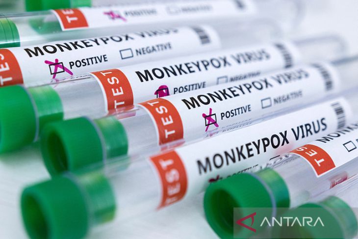 British health officers discover a new variant of monkeypox