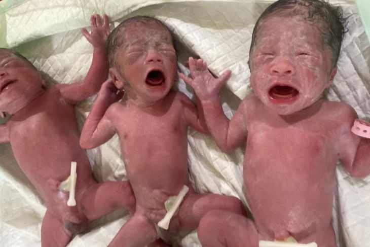 Tim Dokter RSUD Panglima Sebaya berhasil tangani bayi kembar tiga