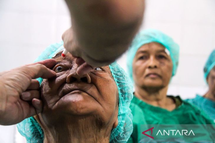 FOTO - Operasi Mata Katarak Gratis Hari Lanjut Usia Nasional (HLUN) 2024