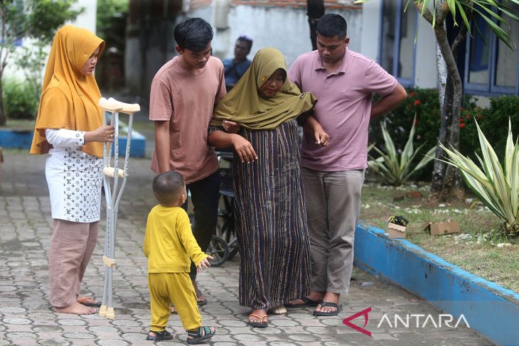 FOTO - Pemasangan kaki palsu