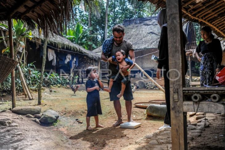 Pemberian vitamin A kepada anak pedalaman Suku Badui