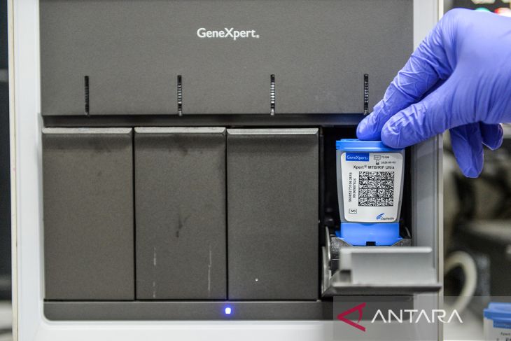Kasus tuberkolosis di Indonesia
