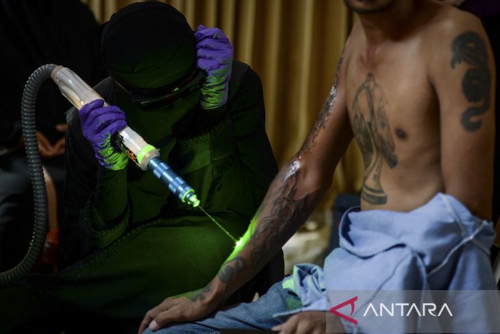 Program layanan hapus tato gratis di Tangerang