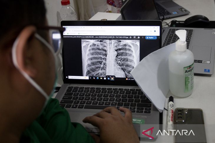 Skrining TBC di lapas Indramayu