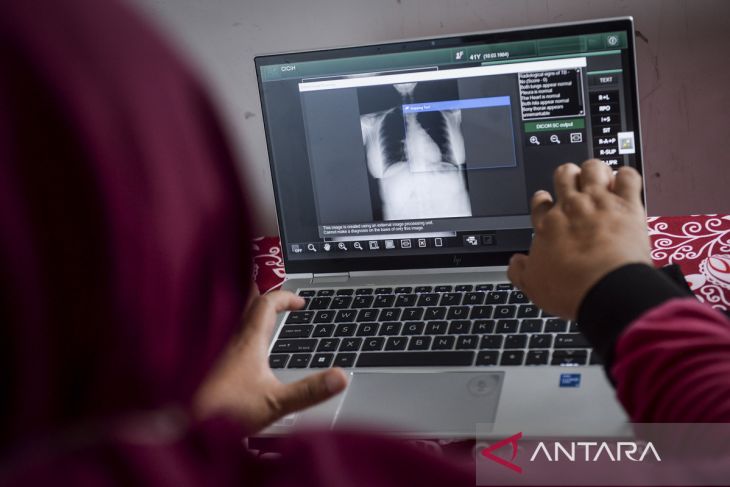 Rencana perluasan program layanan skrining terpadu