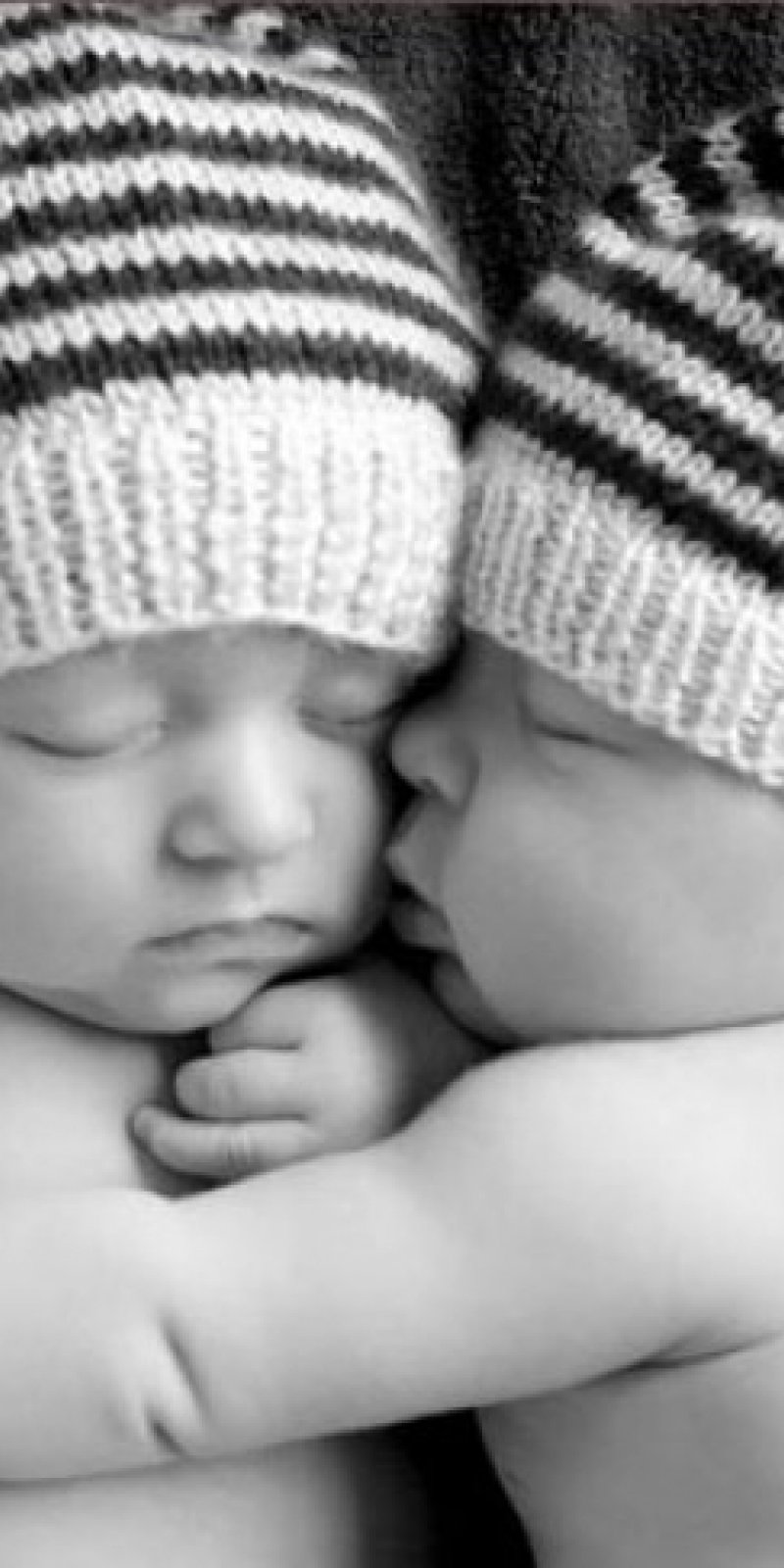 Orang Tua Bayi Kembar Siam Kesulitan Biaya Operasi Antara News
